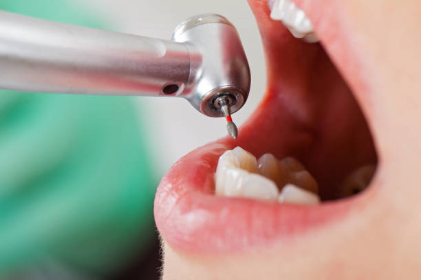 Best Cracked Tooth Emergency Dentist  in Ronkonkoma, NY